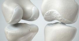 Nguyên nhân, triệu chứng và điều trị lỏng khớp gối