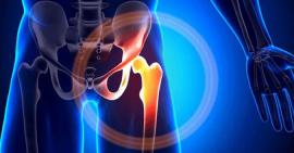 Nguyên nhân gây đau khớp háng ở phụ nữ và cách điều trị theo nguyên nhân