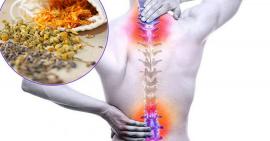 Lạm dụng thuốc dân gian chữa thoái hoá khớp có thể gây tác dụng ngược