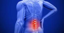 Các triệu chứng thoái hoá đốt sống lưng theo từng giai đoạn