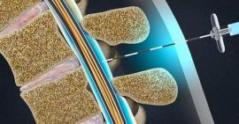 Hậu quả của việc lạm dụng thuốc tiêm chữa viêm khớp