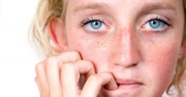 Mụn trứng cá đáng sợ như thế nào?