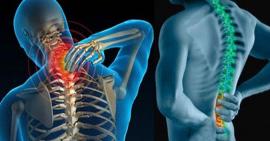4 chứng bệnh cột sống thường gặp ở người trưởng thành