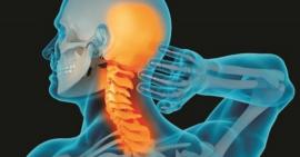 Thoái hoá cột sống cổ gây ra những hội chứng nguy hiểm gì cho người bệnh?