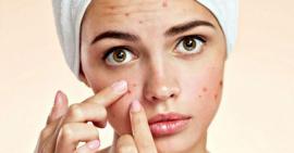 Những thói quen làm hại nhan sắc mà bạn cần biết