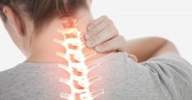 Gai đốt sống cổ ở người trẻ ngày càng nhiều