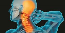 Nguyên nhân, biểu hiện và cách điều trị thoái hoá đốt sống cổ