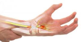 Cần hiểu rõ về bệnh viêm khớp cổ tay để điều trị đúng cách