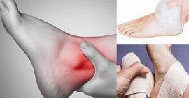 4 bước sơ cứu khi bị trật khớp chuẩn nhất bạn cần biết