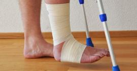 Sau gãy xương mác thì bao lâu tâp đi được?