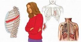 Cảnh báo nhiều bệnh lý nguy hiểm gây đau xương sườn