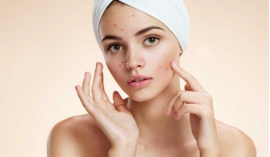 Giải pháp nào cho làn da khi bùng phát mụn?