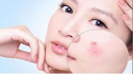 Dưa chuột với công dụng dưỡng da mang lại hiệu quả không ngờ đến