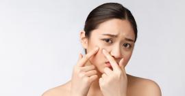 4 điều cơ bản không được quên khi trị mụn