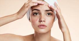 6 cách trị mụn đầu đen được tiết lộ từ các chuyên gia da liễu hàng đầu