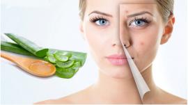 7 nguyên liệu thiên nhiên giúp trị mụn hiệu quả an toàn