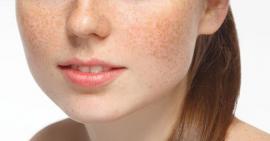 Bổ sung những thực phẩm tốt cho làn da nám