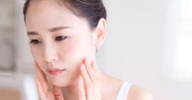 Tuân thủ những nguyên tắc chung trong điều trị mụn