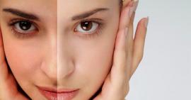 Ảnh hưởng của việc thức khuya đối với làn da