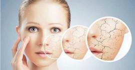 8 điều cần lưu ý khi chăm sóc da khô