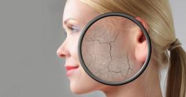 5 triệu chứng thường gặp về da nếu bạn không sử dụng kem chống nắng