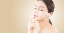 Bật mí 2 công thức vàng giúp bạn chống lão hoá hiệu quả