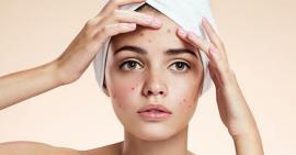 Kem dưỡng da không rõ nguồn gốc gây hại như thế nào?