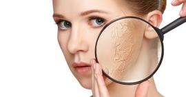 6 điều quan trọng bạn nên ghi nhớ khi sở hữu làn da khô