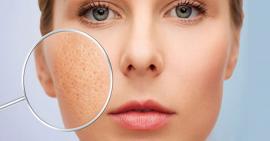Mẹo làm se khít lỗ chân lông ở mặt đơn giản tại nhà