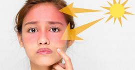 Khám phá nguyên nhân gây cháy nắng da và cách xử lý