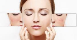 Điểm qua những thủ phạm khiến da mặt bạn xấu đi