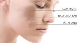 Đẩy lùi lão hoá da hiệu quả tại nhà cho tuổi 30