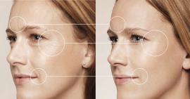 Những kiến thức về xoá nếp nhăn trên mặt bạn cần biết