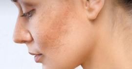 Gợi ý một số mặt nạ từ thiên nhiên giúp thổi bay da khô nám