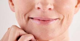 Mách bạn 4 cách làm mờ rãnh cười cho tuổi 30 hiệu quả