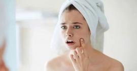 3 cách trị mụn ẩn dưới da hiệu quả bất ngờ