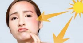 Làm sao để phòng ngừa da bị nám nắng do mặt trời?