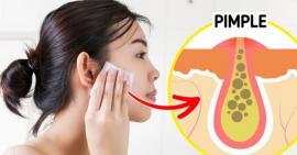10 thói quen gây hại cho da hằng ngày mà bạn cần biết