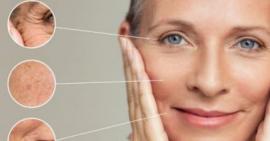 Da mặt bị đứt gãy collagen gây những hậu quả gì cho làn da?