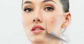 Mụn có khả năng hủy hoại da mặt không?