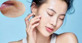 Da khô mùa đông nên làm gì để luôn mềm mịn, trắng hồng?