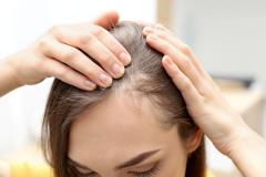 40 tuổi tóc rụng nhiều do đâu? Cách nào khắc phục hiệu quả?