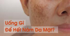 Uống Gì Để Hết Nám Da Mặt? Chữa Nám Da Mặt Tại Nhà