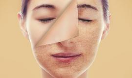 Hướng dẫn bổ sung collagen cho da mặt đúng cách và an toàn