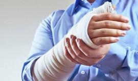 Bị gãy xương ăn nếp được không?