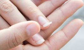 Móng tay yếu hay bị gãy là thiếu chất gì, bị bệnh gì?