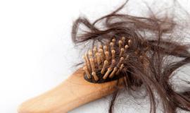 Rụng tóc nhiều ở nữ tuổi 17 có sao không?