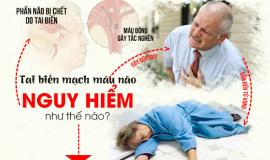 Hướng dẫn cách xử lý khi có dấu hiệu tai biến