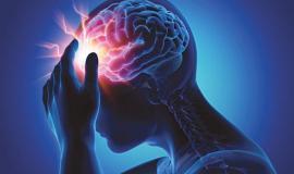 Viên uống hỗ trợ điều trị và phòng ngừa tai biến Nhật Bản tốt nhất hiện nay