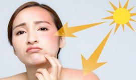 Làm gì để bảo vệ da dưới tia UV mức cao?